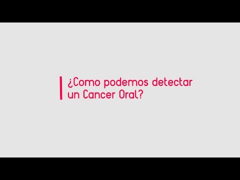 ¿Como se detecta un Cancer Oral?