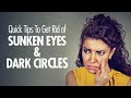 How to Get Rid of Black Circles Around Eyes Fast