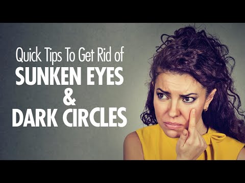 Watch lagu Images Videos Actress With Sunken Eyes, Watch Images Actress With Sunken Eyes free Watch Images, Watch Images Actress With Sunken Eyes