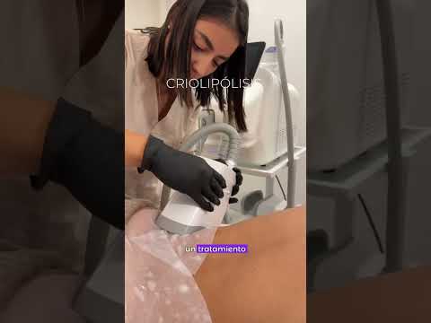 Santé Clínica Estética Barcelona