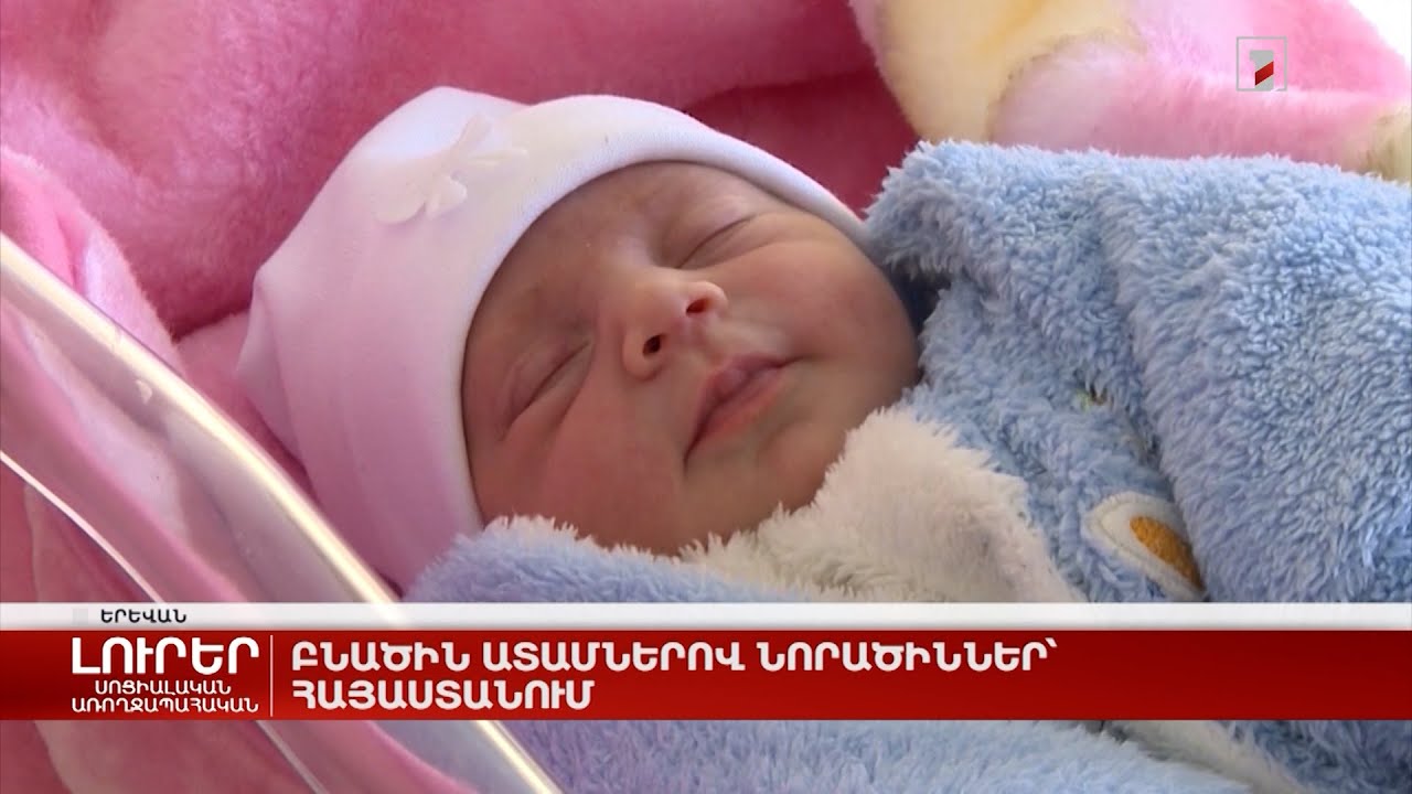 Բնածին ատամներով նորածիններ՝ Հայաստանում