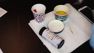 Check up Urine test strips