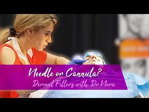 Cheek and Under Eye Hollow Dermal Fillers for Men | Cannula vs Needle Analysis