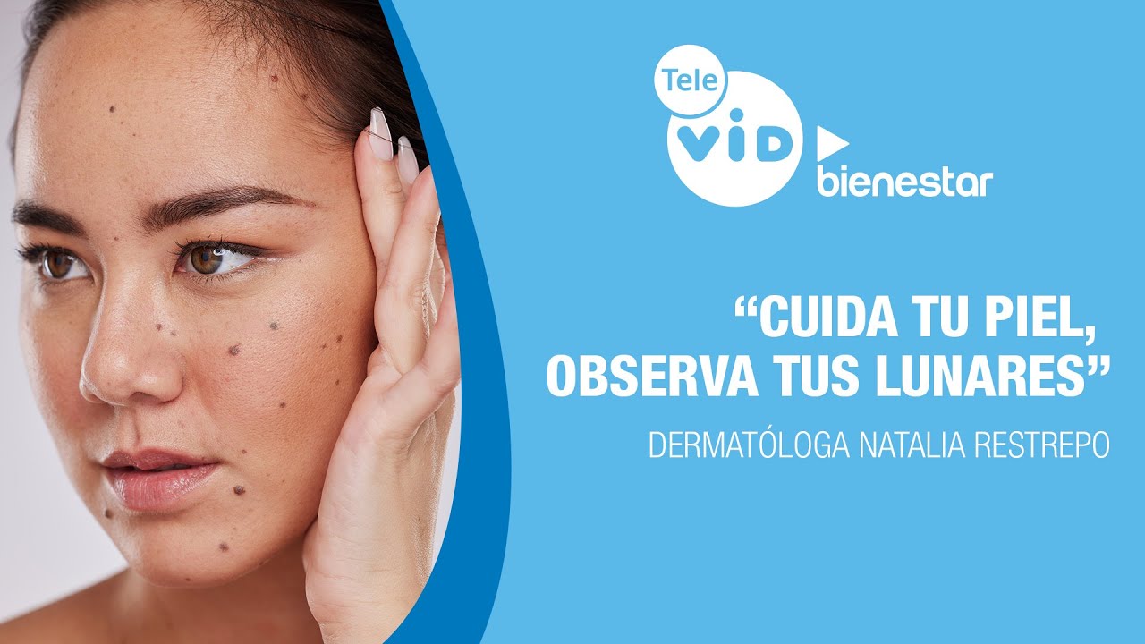 🏥💉“Cuida tu piel, Observa tus Lunares”, Salud VID - Tele VID ▶️ Bienestar