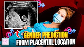 Can you predict your baby's sex with The Ramzi Theory (placenta location)