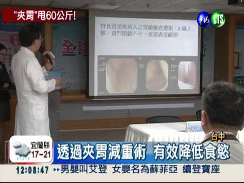 首創"夾胃"減重! 男子甩肉60公斤