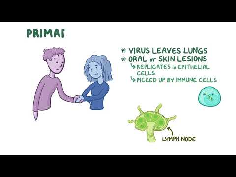 Varicella Zoster Virus | Osmosis