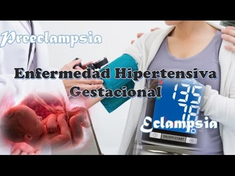 Sanatorio para pacientes hipertensos en la región Nizhny Novgorod Distonía tipo hipertónico