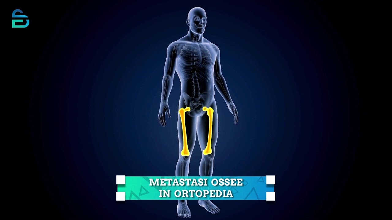 Alessandro Bruschi-7