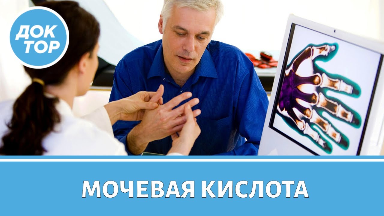 Почему важно знать свой уровень мочевой кислоты