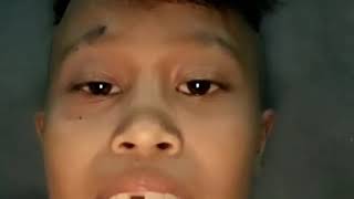 Download lagu Entong Kopit | LU PADA JANGAN MABOK LAGI mp3