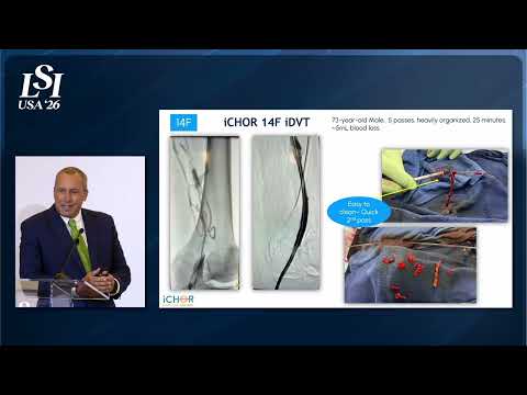 Timothy Blair, ICHOR Vascular Inc. - Endovascular clot removal with embolic protection | LSI USA '26