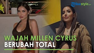 Wajah Millen Cyrus Berubah Total Setelah 4 Kali Oplas Hidung, Jadi Agak Kebule-bulean