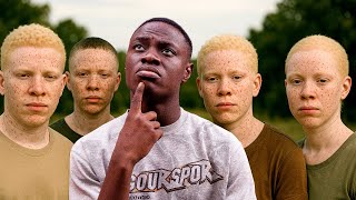 The Albino Village. A Community Full Of Albinos 😳