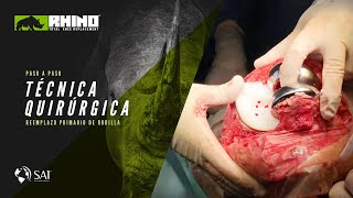 Video de producto