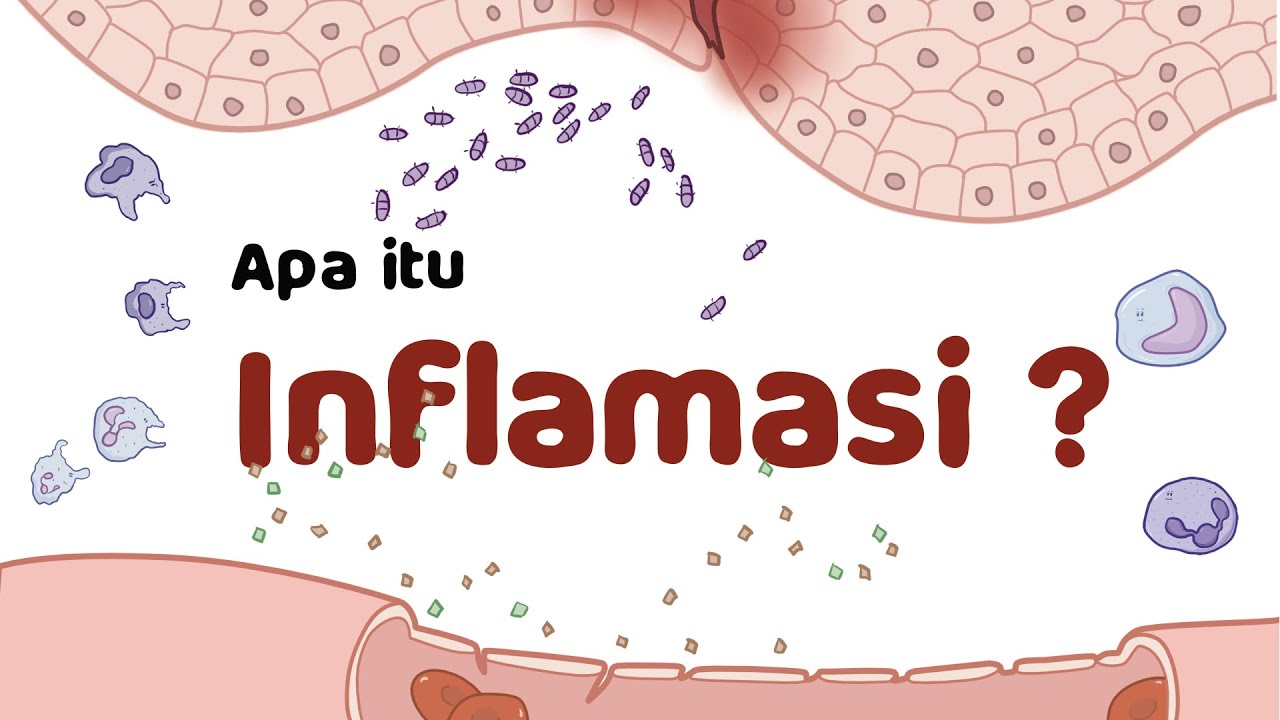 Apa Itu Inflamasi ??? ._.