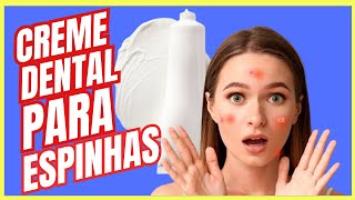 Creme dental para espinhas.#acnes #espinhas #manchanorosto #pastadedente #cremedental #mancha