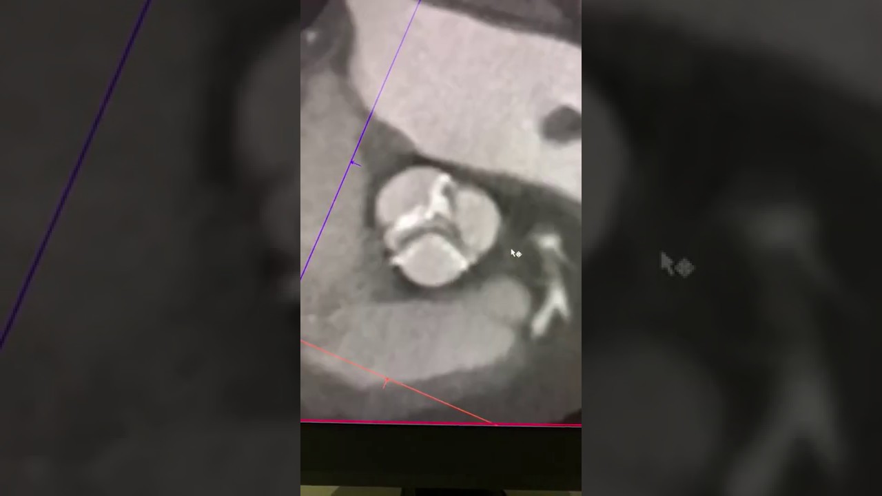 Ayax N. Sobrino Saavedra-11