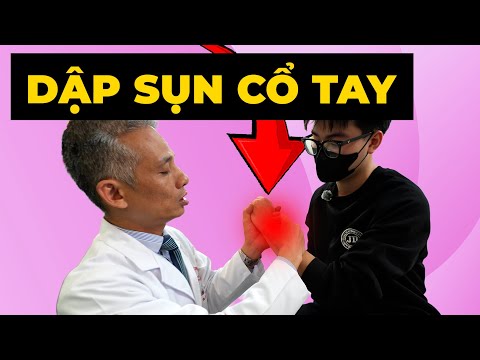 Đau cổ tay mãi không hết sau ngã xe? Có thể bạn đang dập sụn