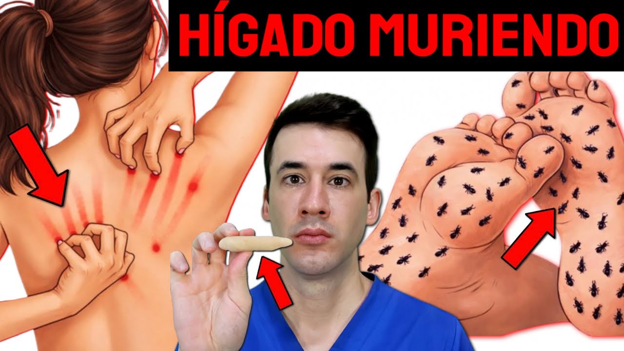 ¡ALERTA! HÍGADO MURIENDO: ASÍ se CURA el DAÑO HEPÁTICO