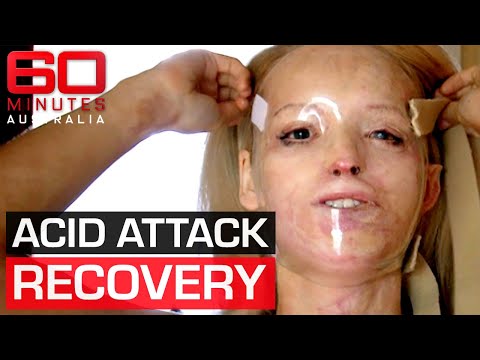 Acid attack survivor's inspirational journey to recovery | 60 Minutes Australia