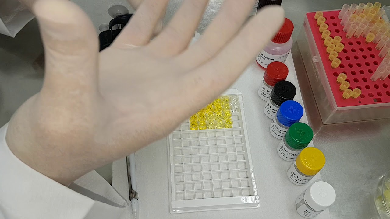 IMUNOLOGIA - Aula prática de ELISA (parte 2)