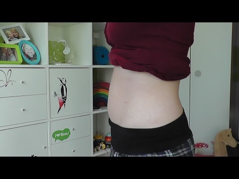 Joint Tennis Osteochondrose nach einer Brustoperation