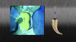 Tango-Endo Instrumentation System: It only takes two!