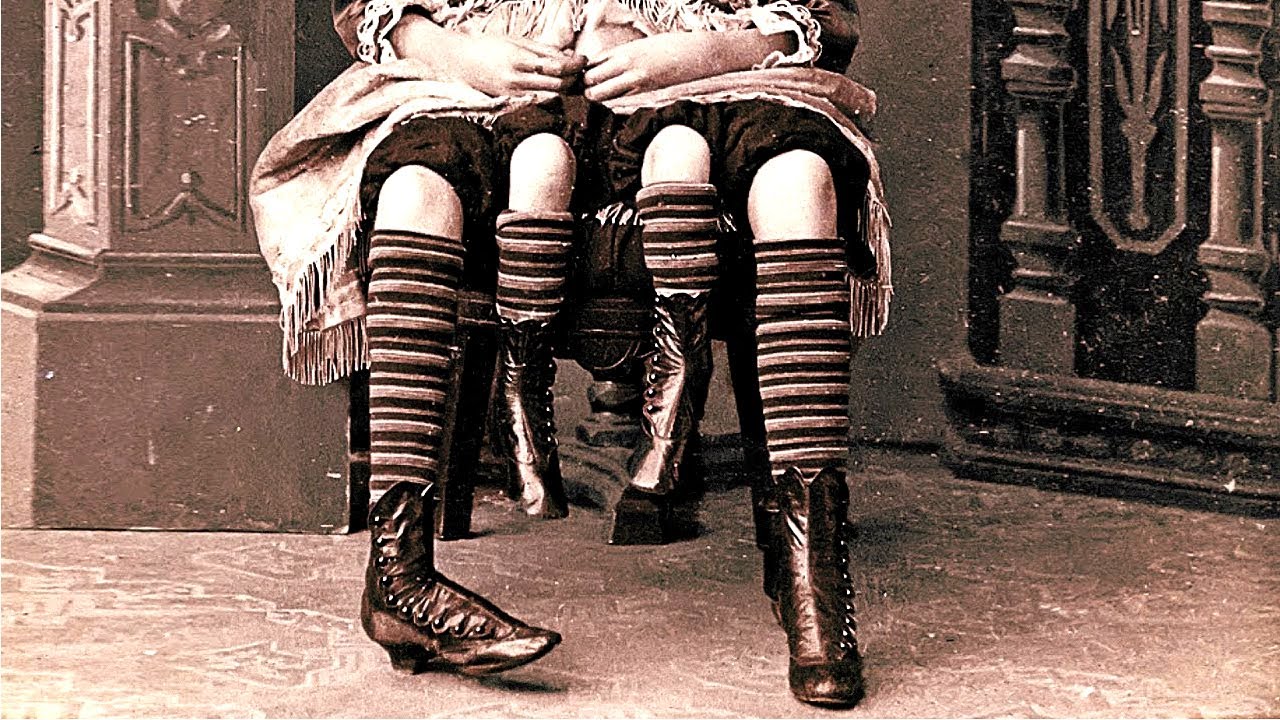 The Story of Myrtle Corbin, the Real Life Four Legged Girl