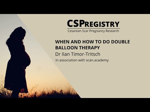 CSP Registry Masterclass - When and how to do double balloon therapy - Dr Ilan Timor-Tritsch