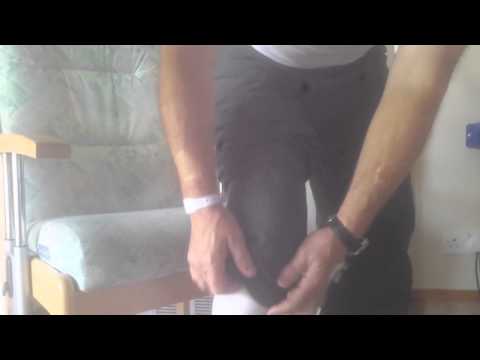 Day Case Total Knee Replacement. Attune Knee Replacement