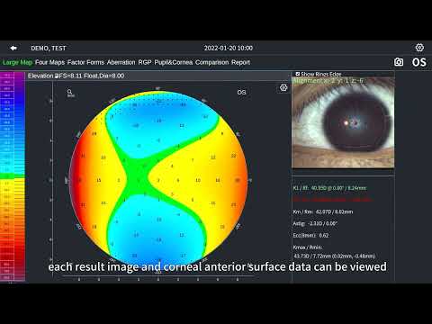 Corneal Topography Machine