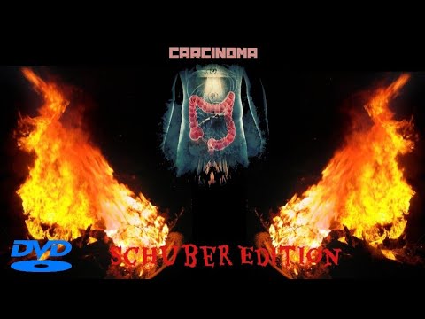 Carcinoma  -Limited Edition-