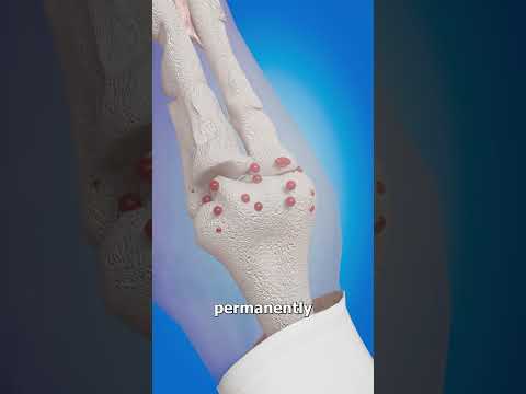 What Happens If You Never Lower Your Arms 😨