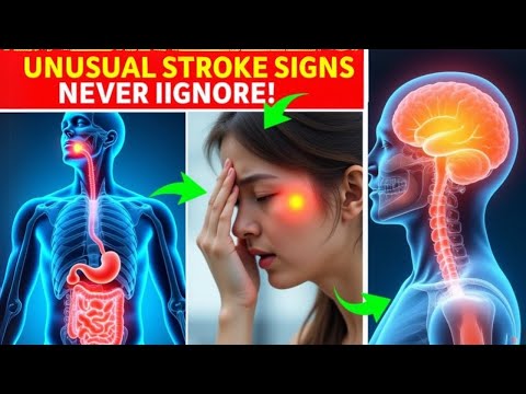 5 Uncommon Signs of Strokes You Should Know About! Doctor Explains