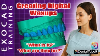 EXOCAD 3.2 TRAINING COURSE / CREATING DIGITAL WAXUPS
