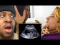 He Got His Step Sister Pregnant