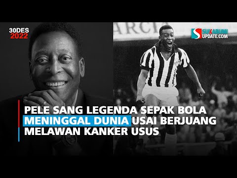 Pele Sang Legenda Sepak Bola Meninggal Dunia Usai Berjuang Melawan Kanker Usus