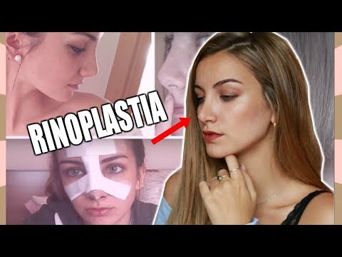 ACTUALIZACIÓN RINOPLASTIA