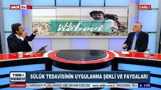 Tıbbi Nebevi - Sülük tedavisinin geliştirilmesi için neler yapılmalı ?