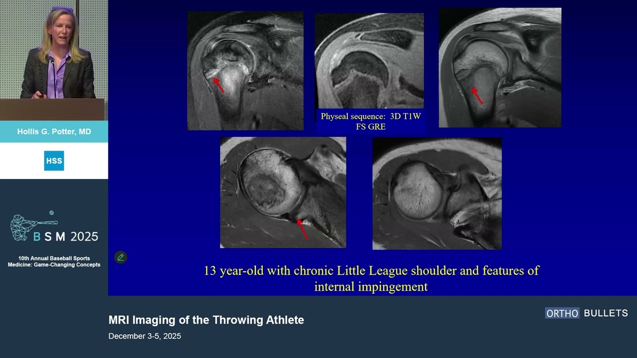 MRI Imaging of the Throwing Athlete_Hollis G. Potter MD