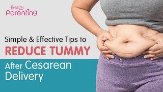 Effective Tips to Reduce Belly After a C-Section Delivery
