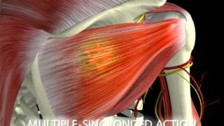 Terapia MLS - Lasery wysokoenergetyczne Mphi i M6