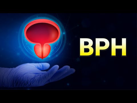 Benign Prostatic Hyperplasia (Enlarged Prostate) - CRASH! Medical Review Series