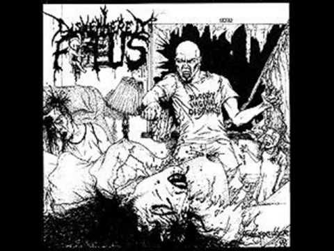 Dismembered Fetus-Violent Grindcore Mix From 