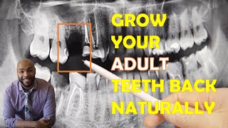 How To Grow Your ADULT Teeth Back Naturally 🦷
