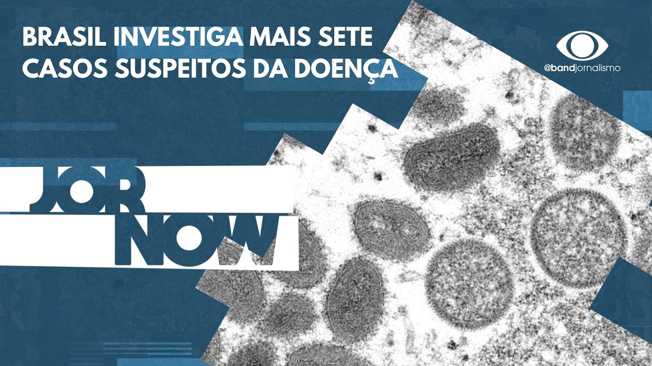 Primeiro caso da varíola dos macacos é confirmado no Brasil