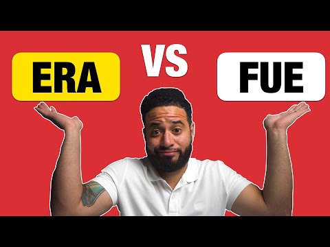 The DIFFERENCE Between Era vs Fue | How To Use Them Correctly!