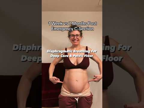 Diaphragmatic Breathing For Postpartum Recovery #health #education #mom #exercise #fyp