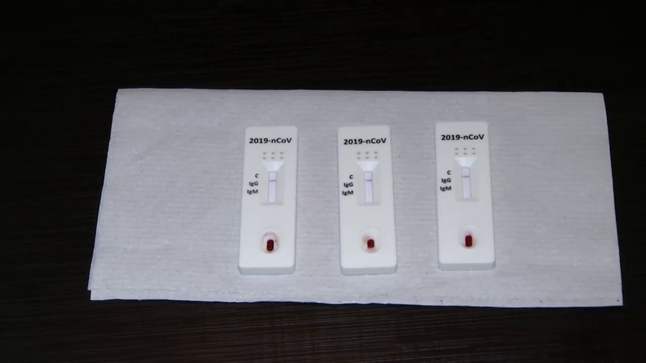 NÚMERO DE TESTES PARA COVID-19 SÃO AMPLIADOS EM SÃO JOSÉ DOS CAMPOS